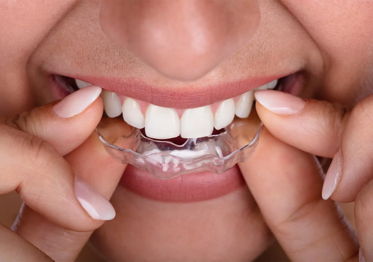 TriBeCa Dental Associates | Murray photo 9