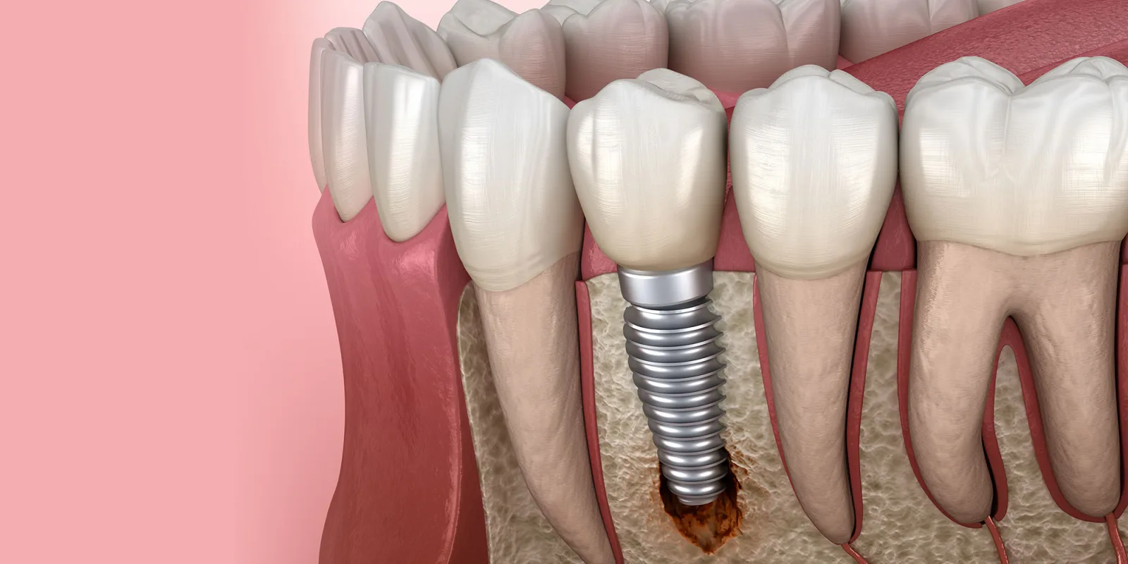 Diamond District Dental NYC - Midtown Dentist