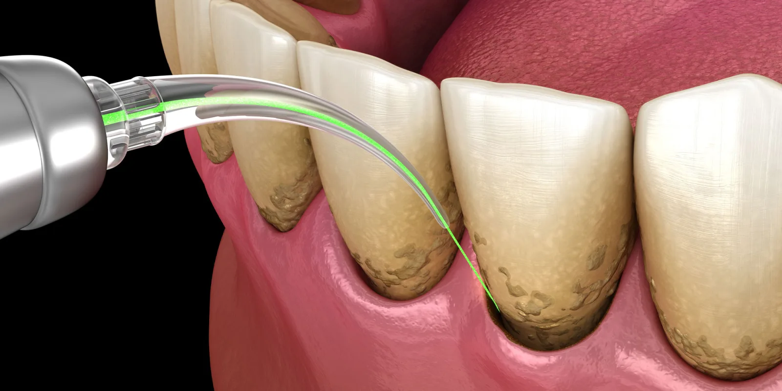 Diamond District Dental NYC - Midtown Dentist photo 2