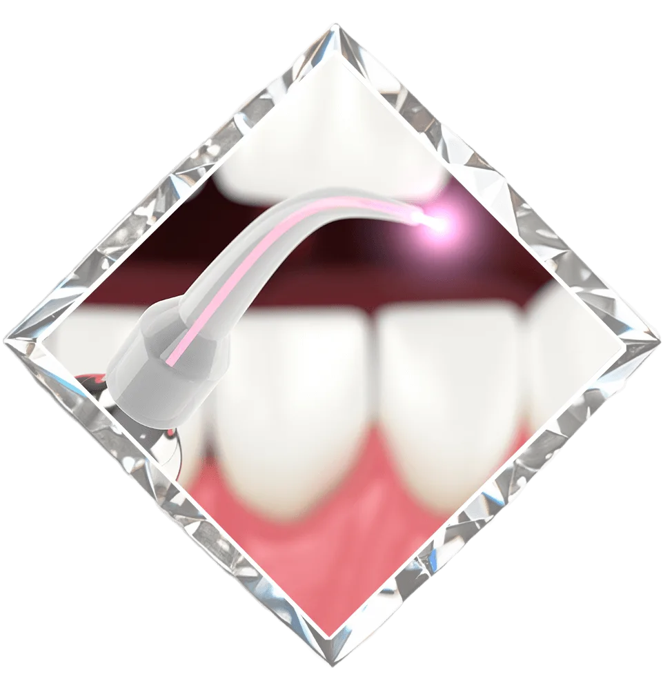 Diamond District Dental NYC - Midtown Dentist photo 8