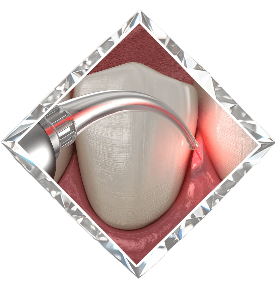 Diamond District Dental NYC - Midtown Dentist photo 10