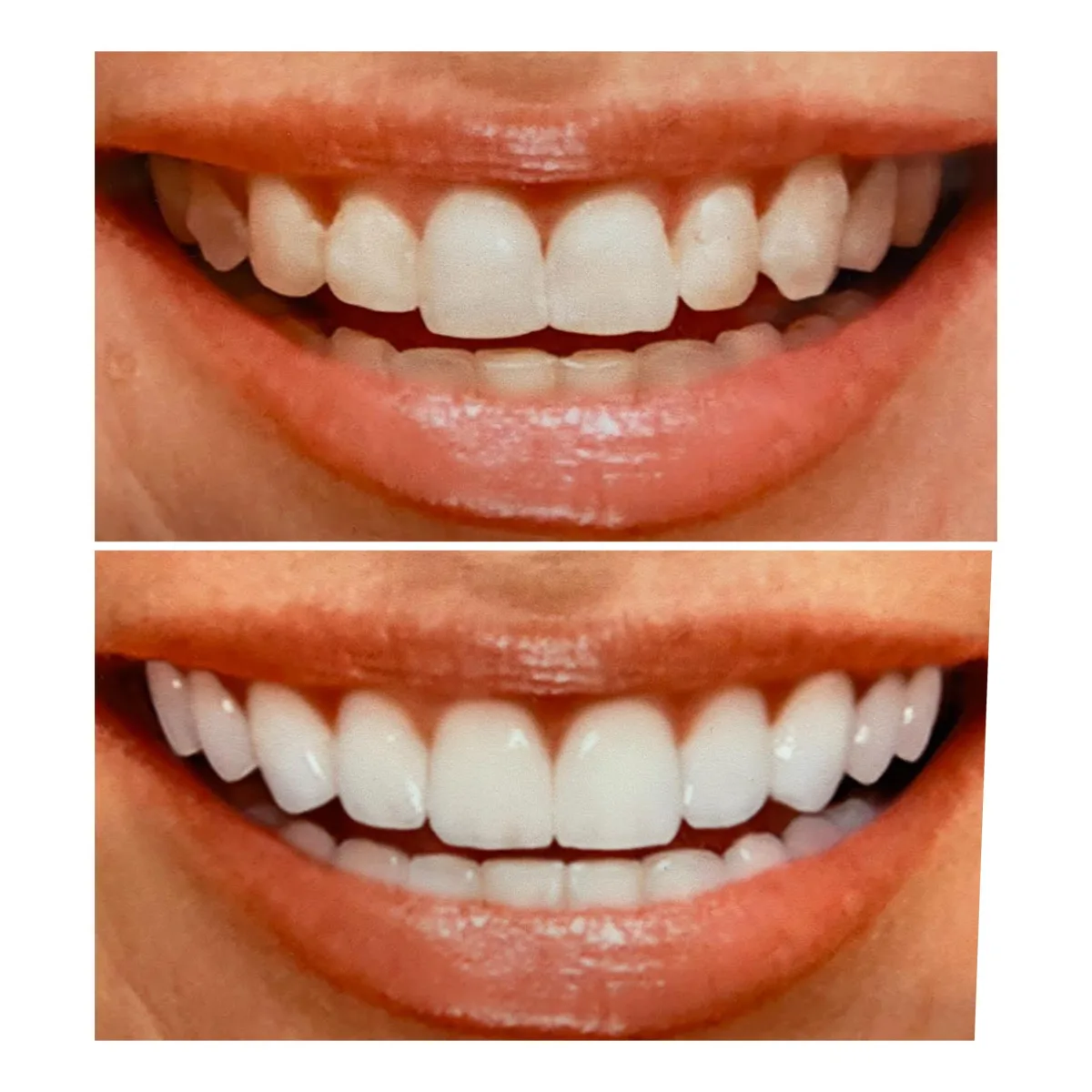 L.A. Smiles Dentistry photo 7