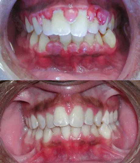 Vernon Family Dental