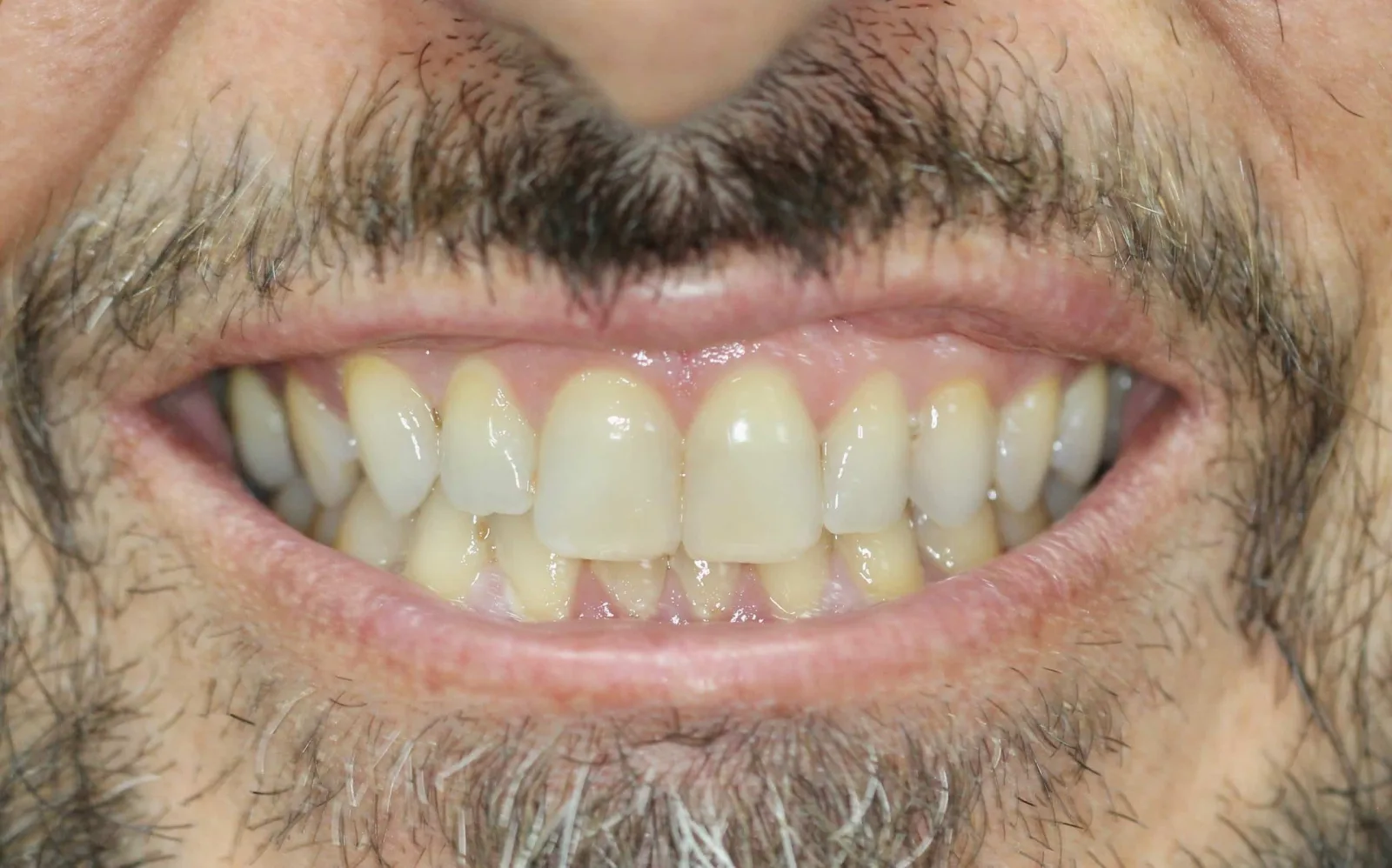 BLVD Dental Aesthetics photo 4