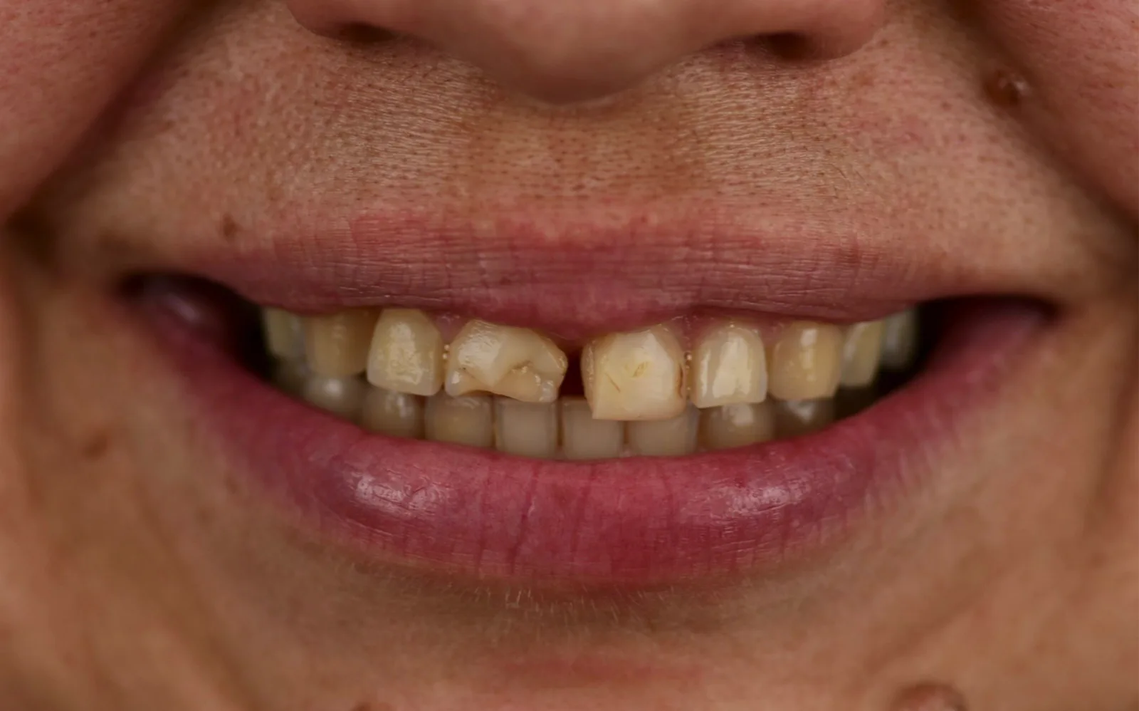 BLVD Dental Aesthetics photo 2