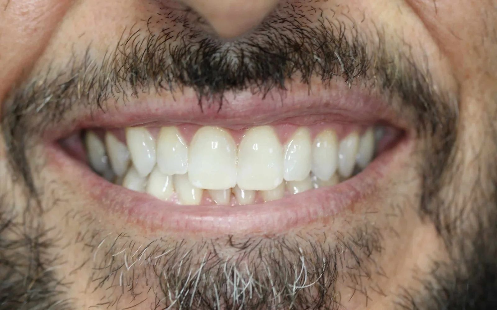 BLVD Dental Aesthetics photo 5