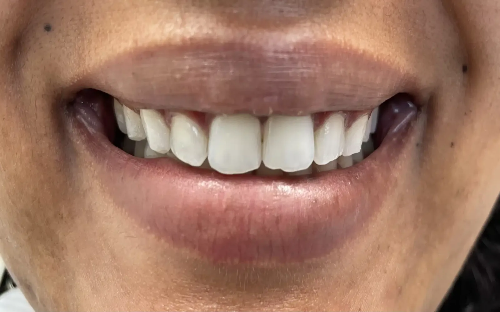 BLVD Dental Aesthetics photo 6