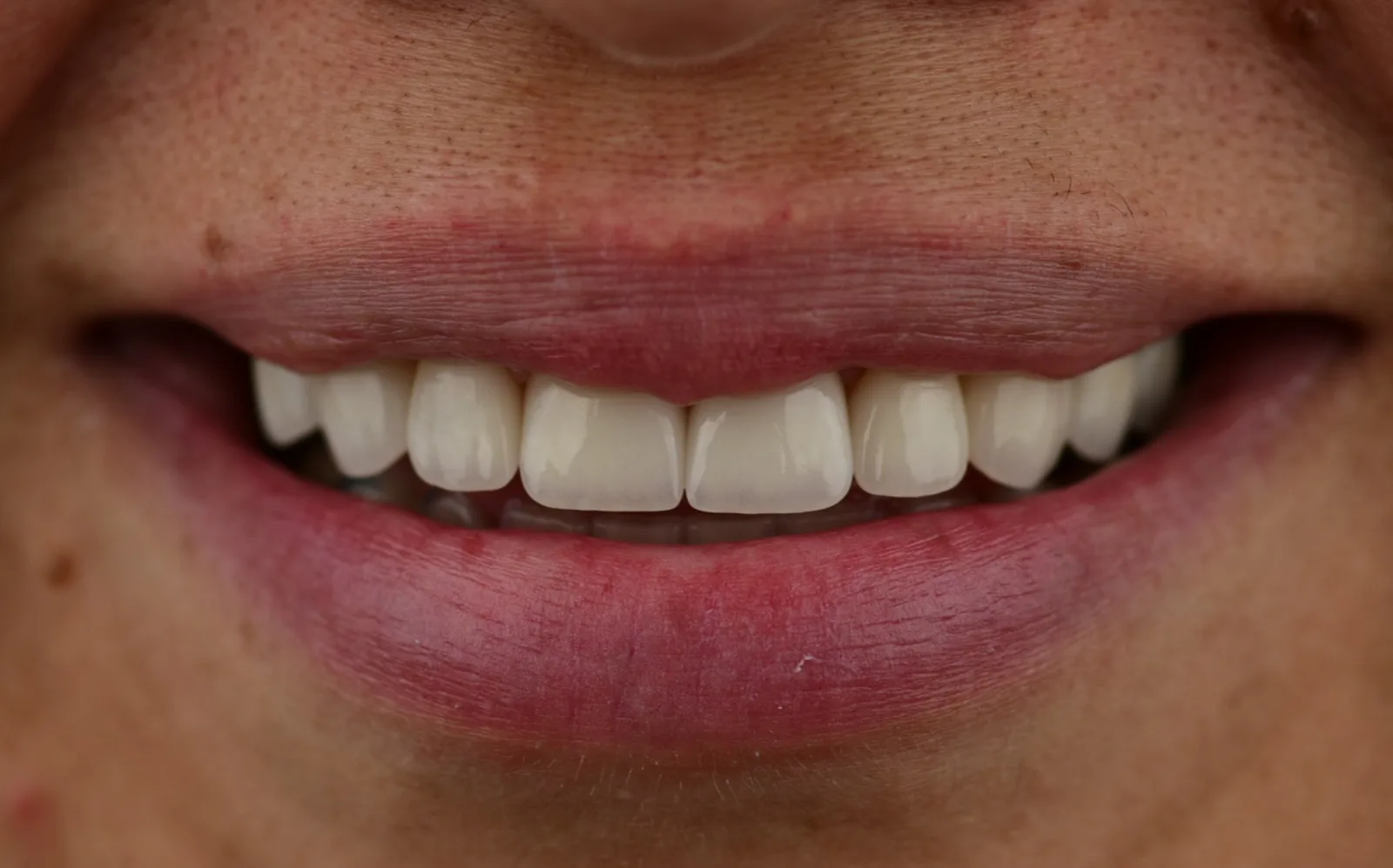 BLVD Dental Aesthetics photo 3
