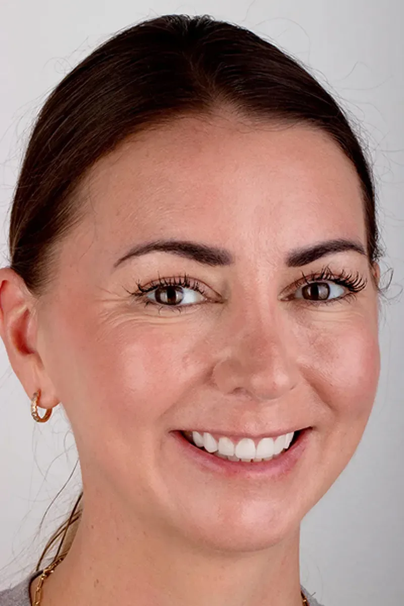 Sapphire Smiles - Dr. Antoun | Leading Cosmetic Dentist in Houston photo 5