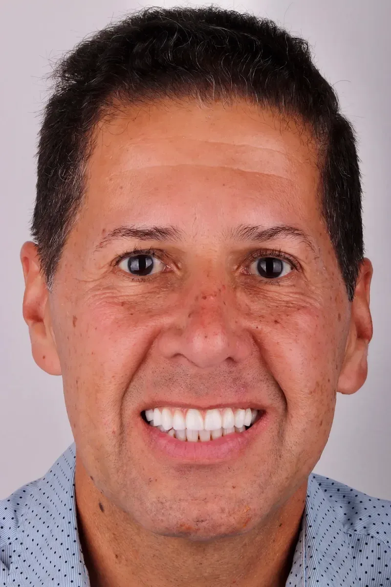Sapphire Smiles - Dr. Antoun | Leading Cosmetic Dentist in Houston photo 7