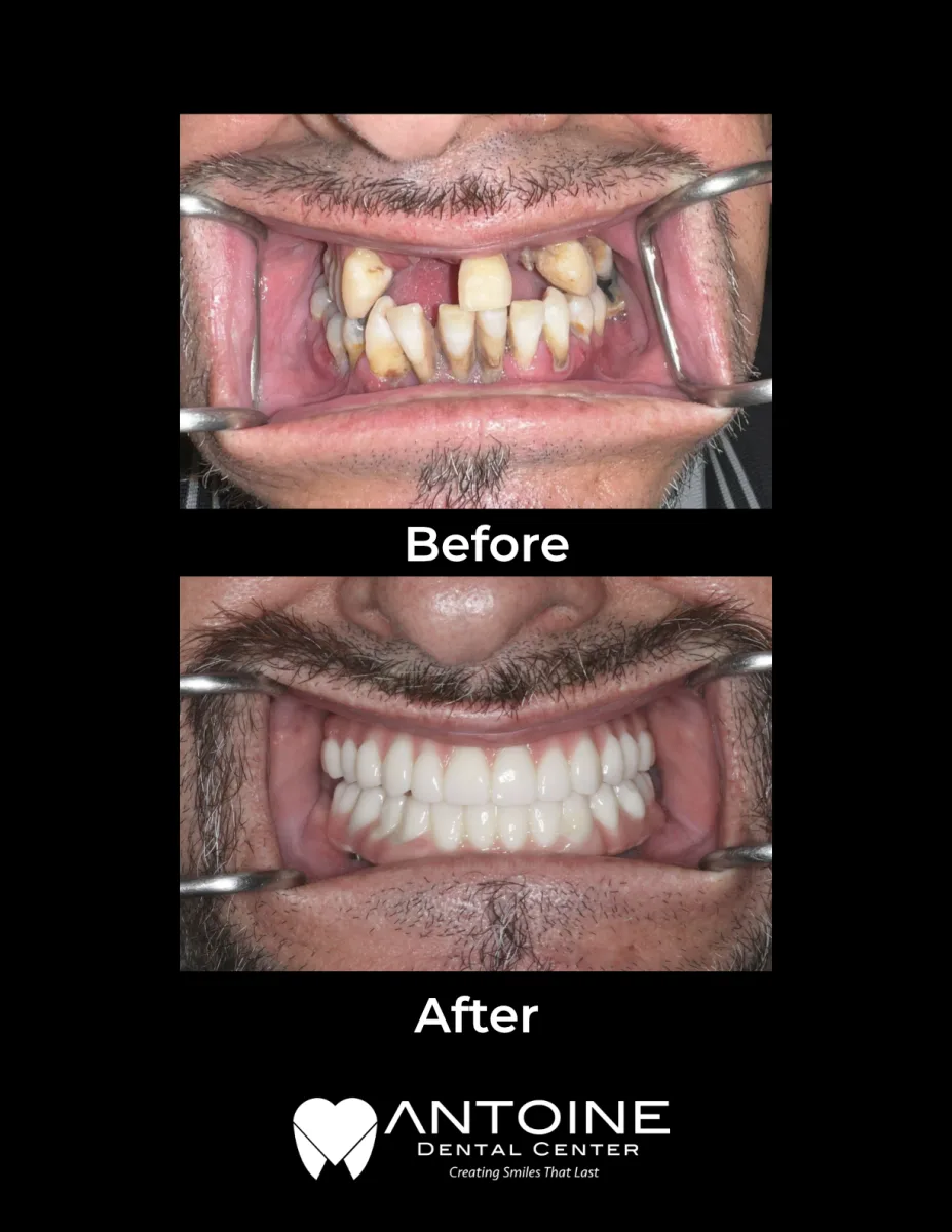 Antoine Dental Center photo 6