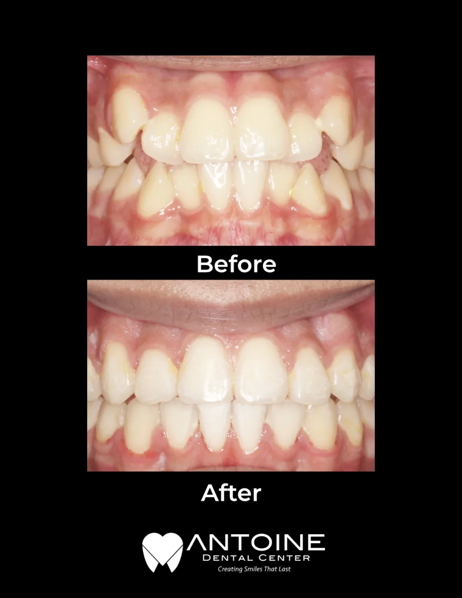 Antoine Dental Center photo 5