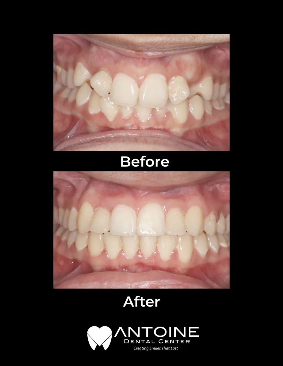 Antoine Dental Center photo 3