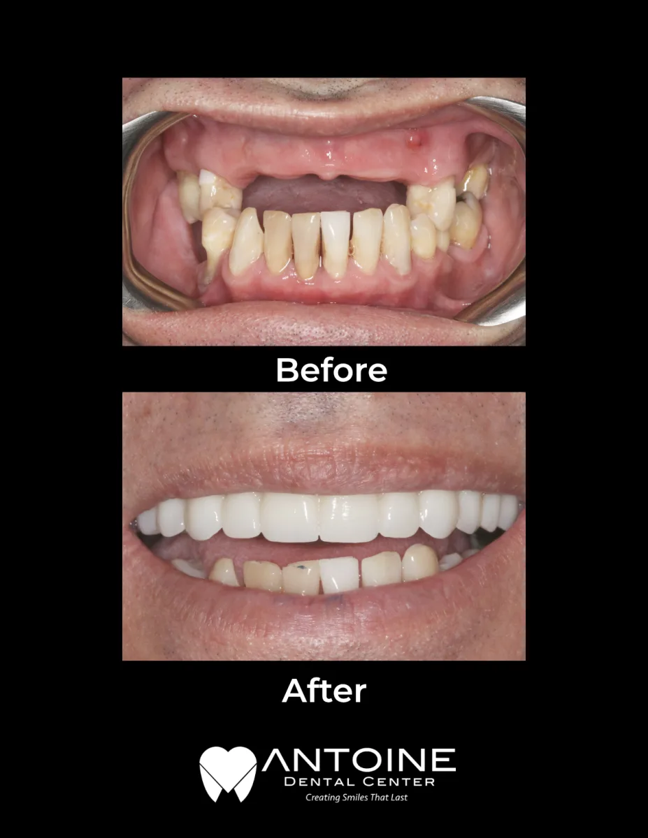 Antoine Dental Center photo 4