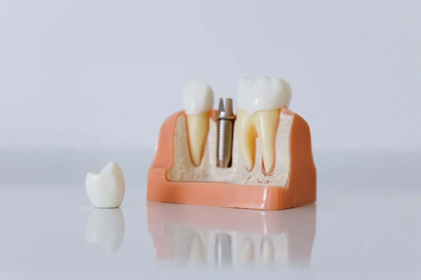 Restore Dental At Montrose photo 2