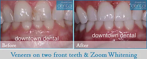 Downtown Dental photo 11