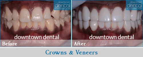 Downtown Dental photo 10