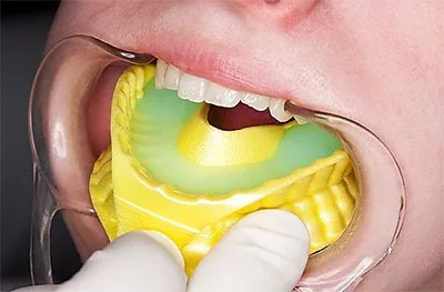 Total Care Dental and Orthodontics | Los Angeles photo 5