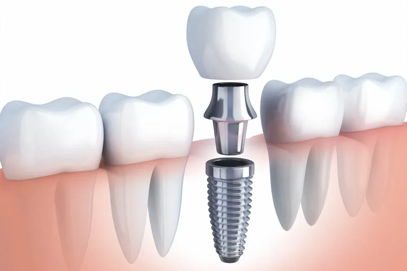 Mindfulness Dental photo 4