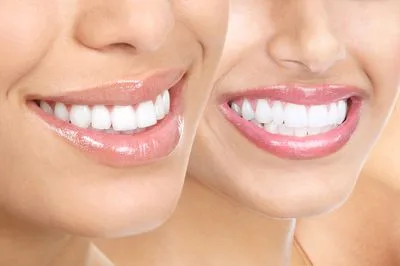 Dr. Arthur A. Kezian, DDS photo 8