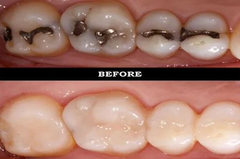 Dr. Arthur A. Kezian, DDS photo 5