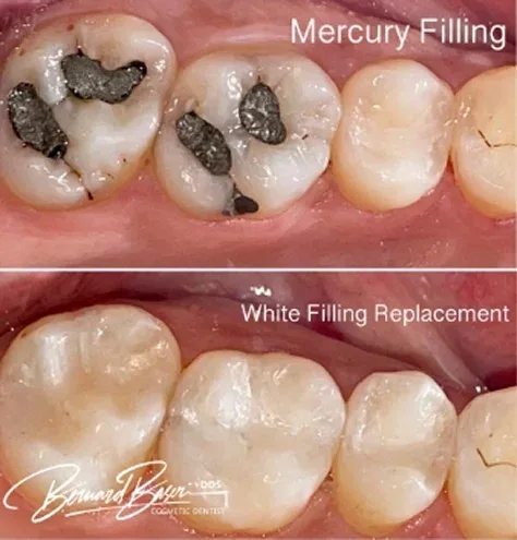 Smile Recreation Dentistry by Dr. Baseri photo 8