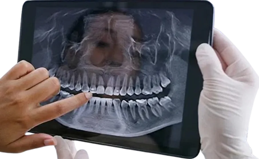 Smile Recreation Dentistry by Dr. Baseri photo 10