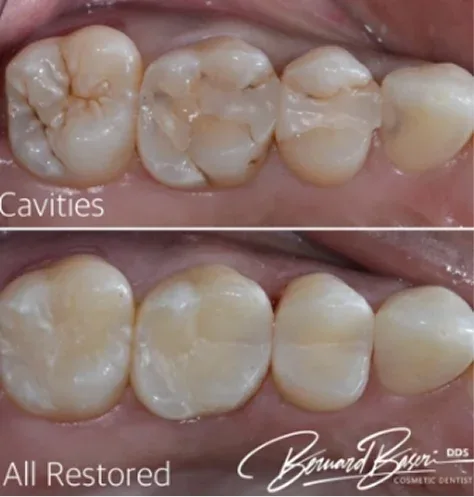 Smile Recreation Dentistry by Dr. Baseri photo 7