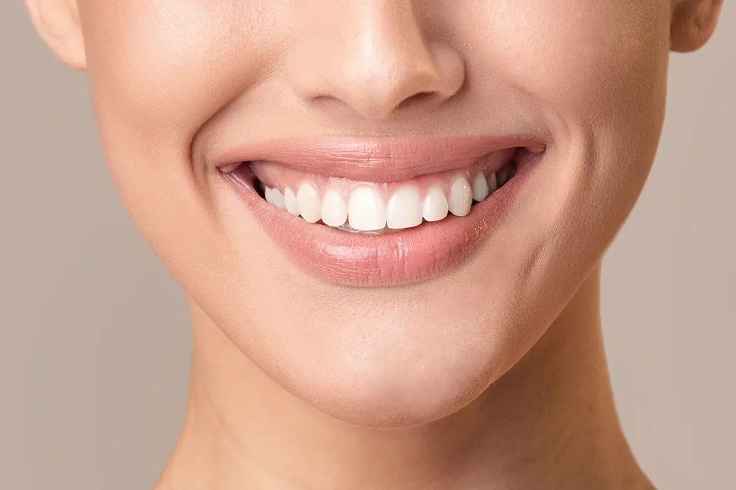 Studio Smiles