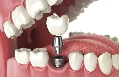 209 NYC Dental photo 10