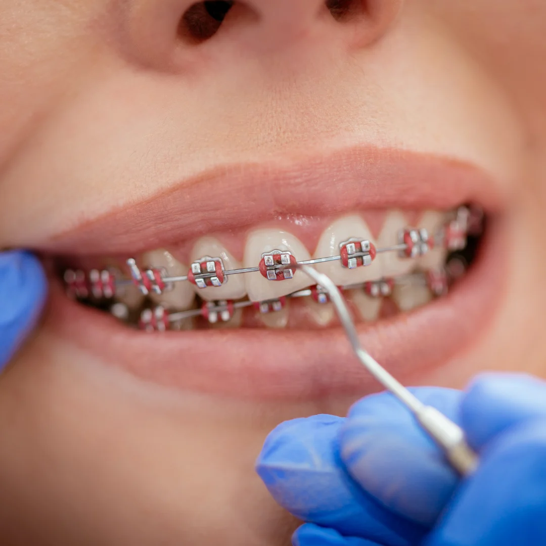 East Greenwich Family Dental photo 3
