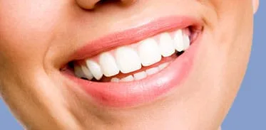 Frenchtown Dental Associates photo 8