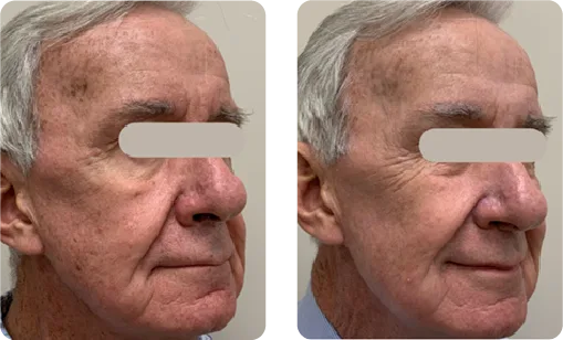 Tokarz Dermatology photo 11