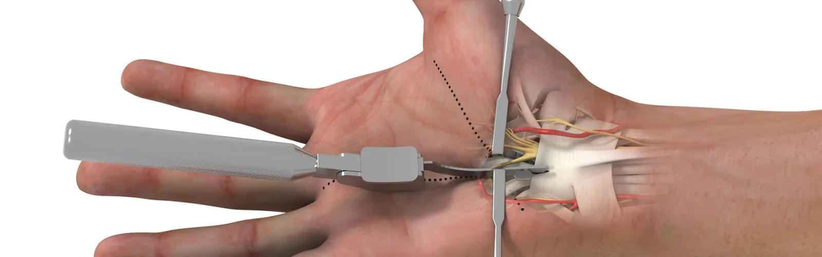S2S Surgical photo 5