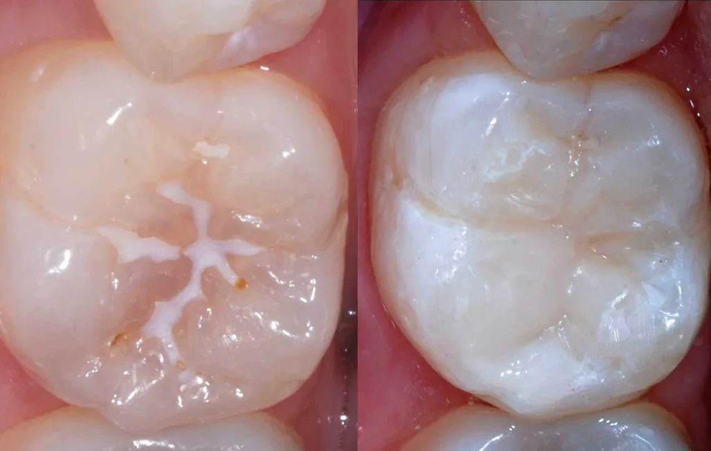 Smith Family Dental Associates photo 11