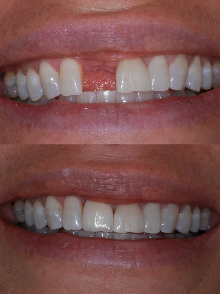 Smith Family Dental Associates photo 10