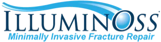 Illuminoss Medical logo