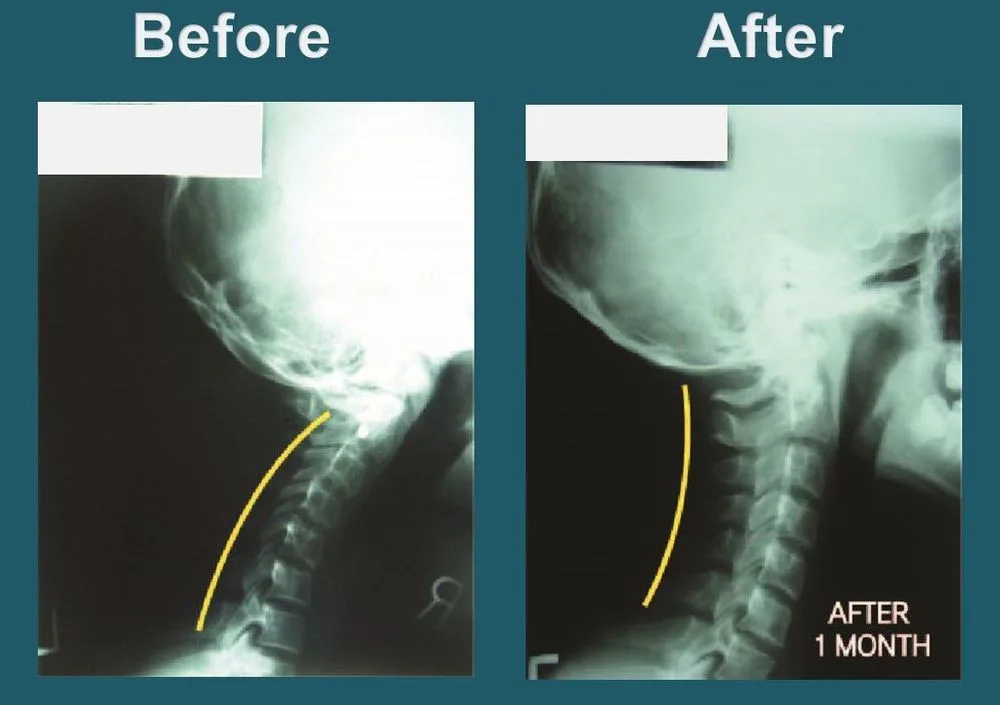 Yonsei Chiropractic Clinic photo 5