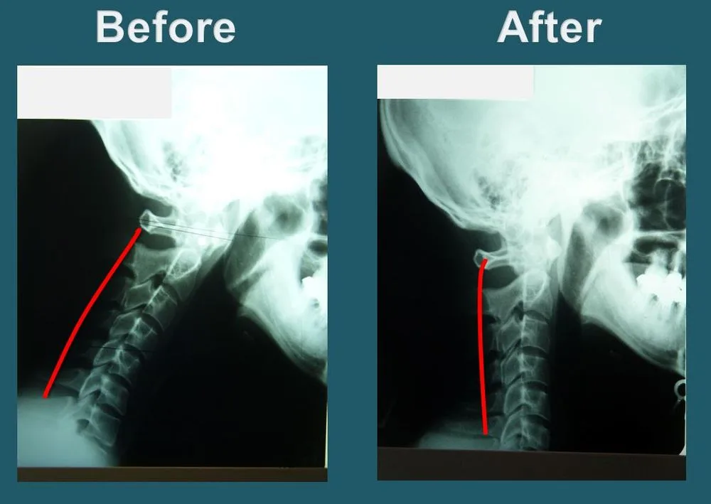 Yonsei Chiropractic Clinic photo 2