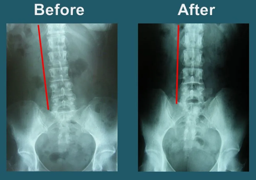 Yonsei Chiropractic Clinic photo 6