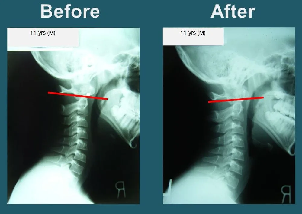 Yonsei Chiropractic Clinic photo 4
